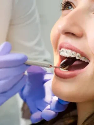 imgi_7_ver-detalle-de-la-hermosa-chica-con-aparatos-dentales